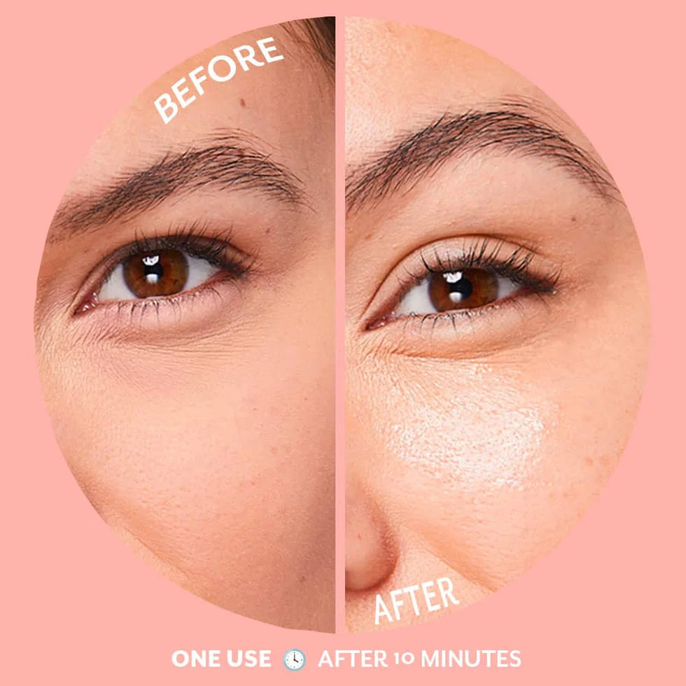 Bubbly Under Eye Gel Patches-5 Pair